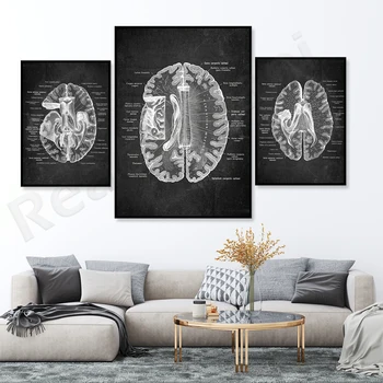 Анатомия Мозг Плакат Структура мозга Медицинское искусство Подарок невролога Подарок психиатра Подарок психолога